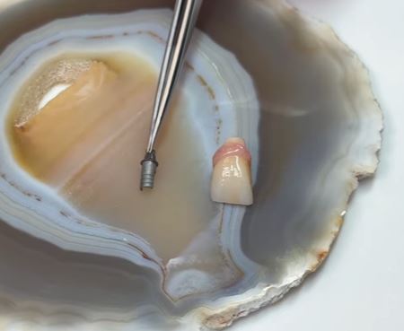 Cementation Of Ti-Bases